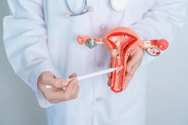 Hysteroscopic Myomectomy